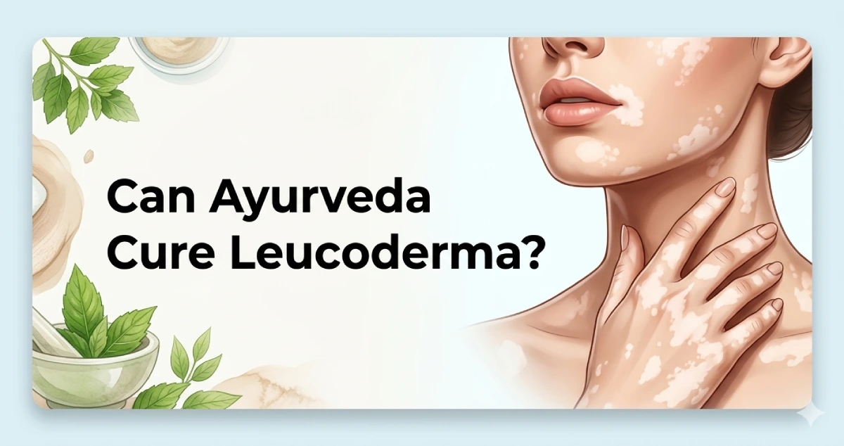 can-ayurveda-cure-leucoderma